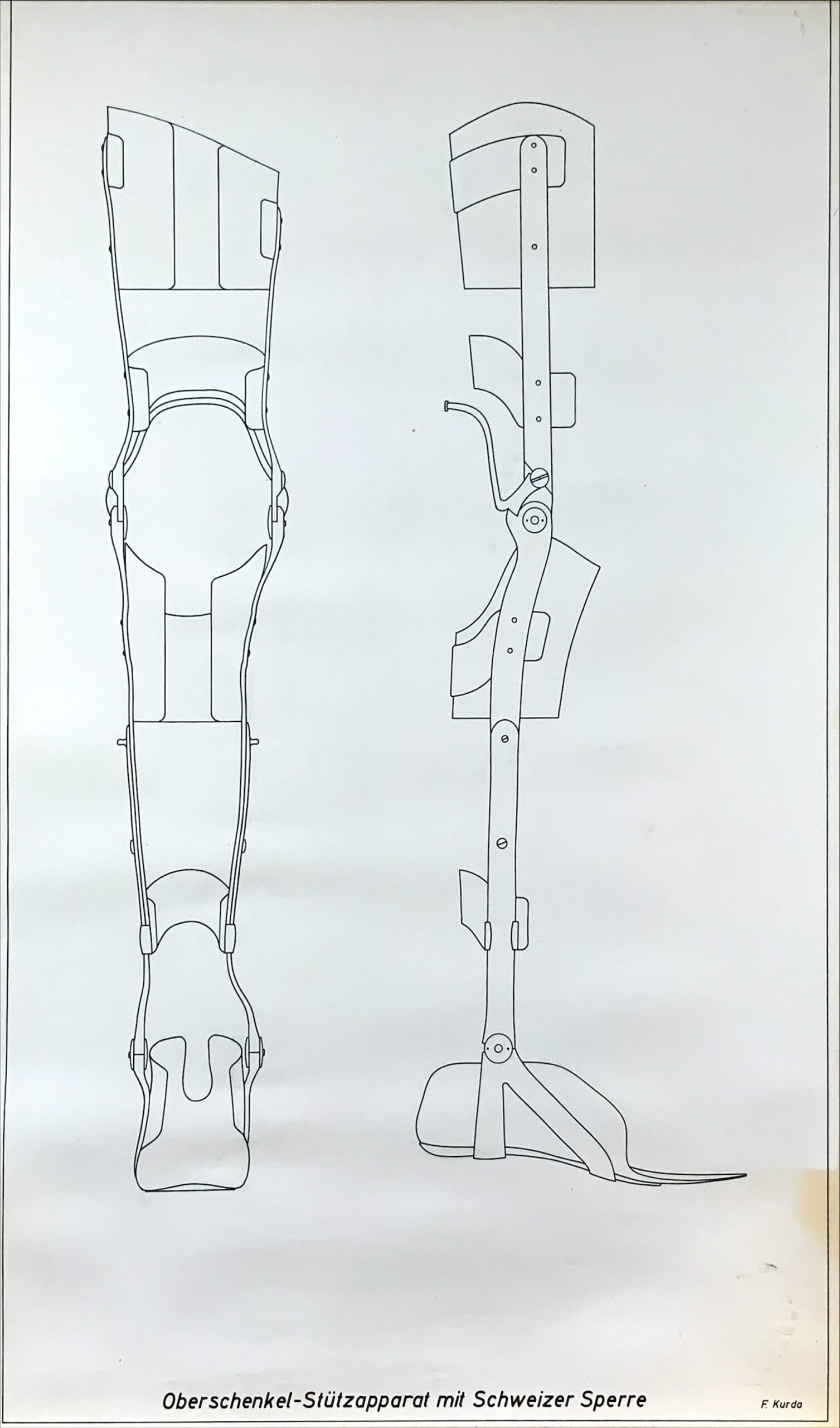 unbekannt03 TechnischeZeichnungen Oberschenkel StuetzapparatMitSchweizerSperre FriedhelmKurda scaled
