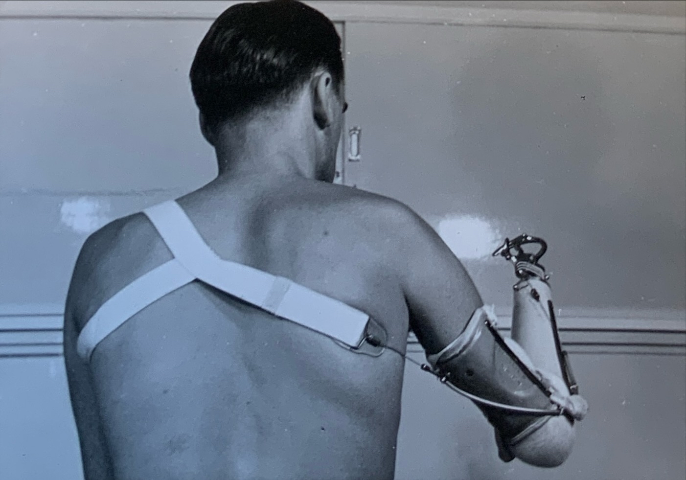 Patientenversorgung 74 unbekannt73 Patientenversorgung Armprothese