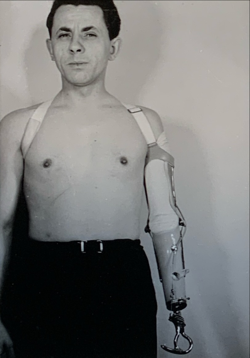 Patientenversorgung 87 unbekannt86 Patientenversorgung Armprothese