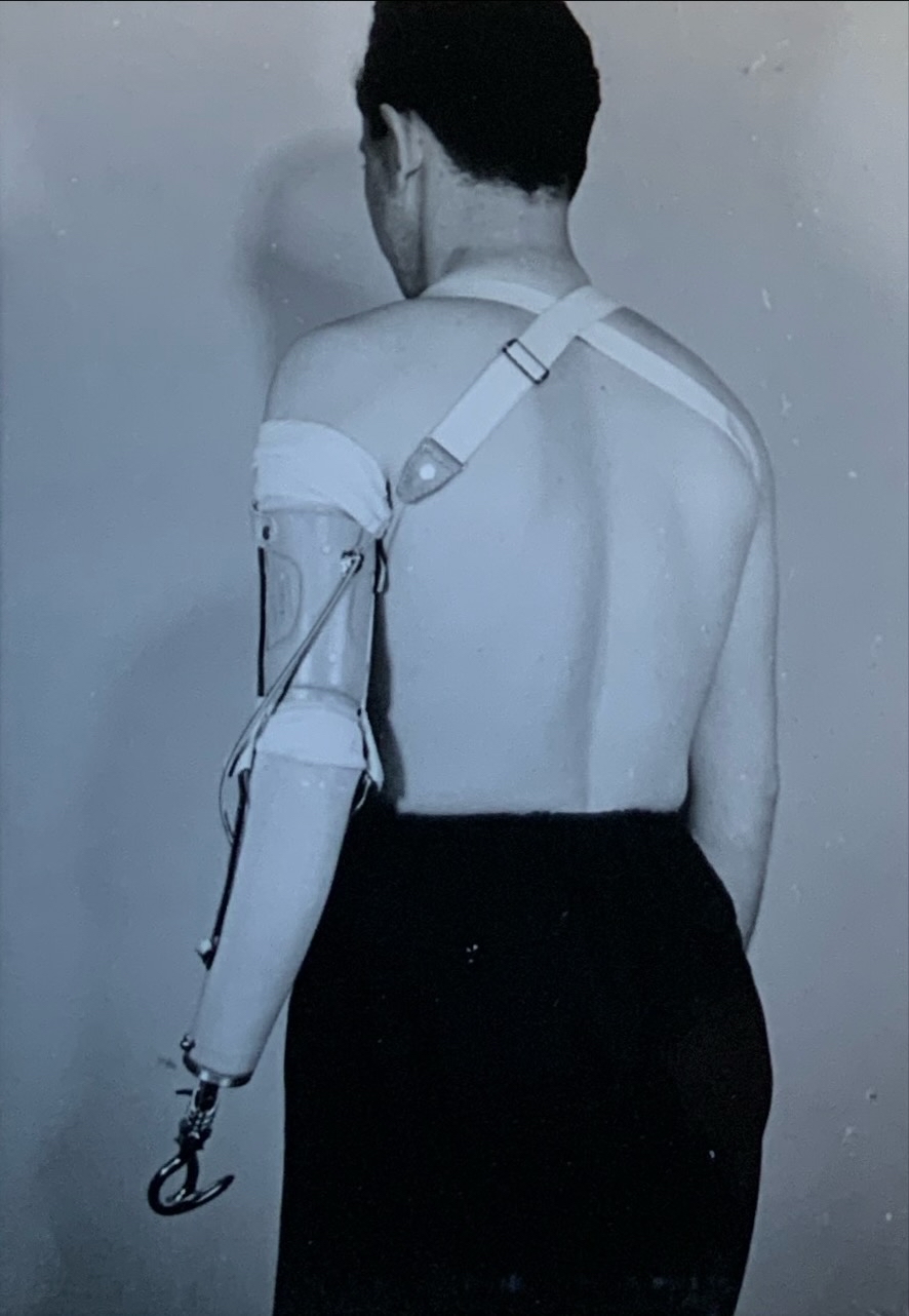 Patientenversorgung 89 unbekannt88 Patientenversorgung Armprothese