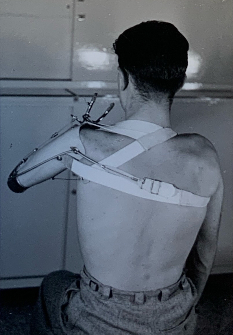 Patientenversorgung 92 unbekannt91 Patientenversorgung Armprothese