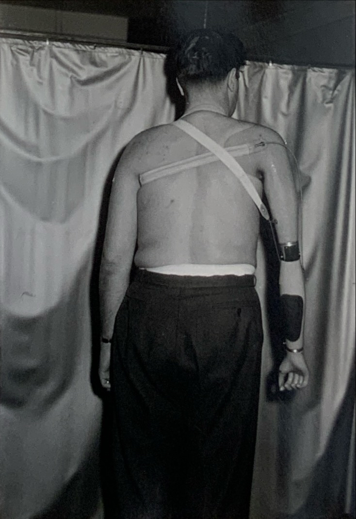 Patientenversorgung 94 unbekannt93 Patientenversorgung Armprothese