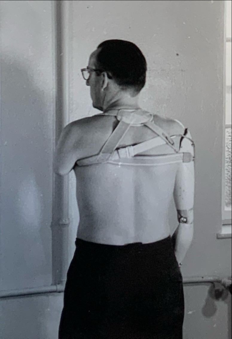 Patientenversorgung 100 unbekannt99 Patientenversorgung Armprothese