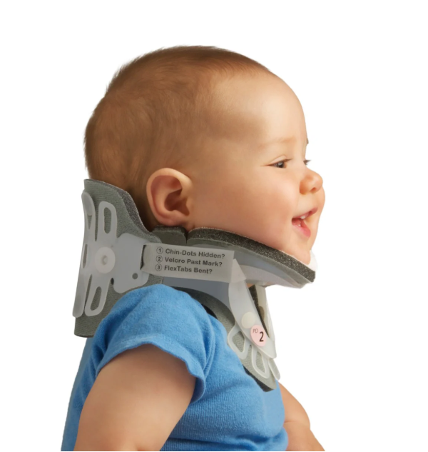 Aspen® Pädiatrische Zervikalorthese 1 Kleinkind mit angelegter pädiatrischer Zervikalorthese zur Stabilisierung und Bewegungseinschränkung der Halswirbelsäule.